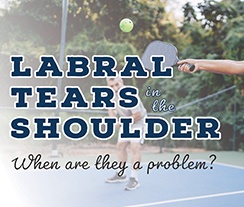 Labral Tears in the Shoulder